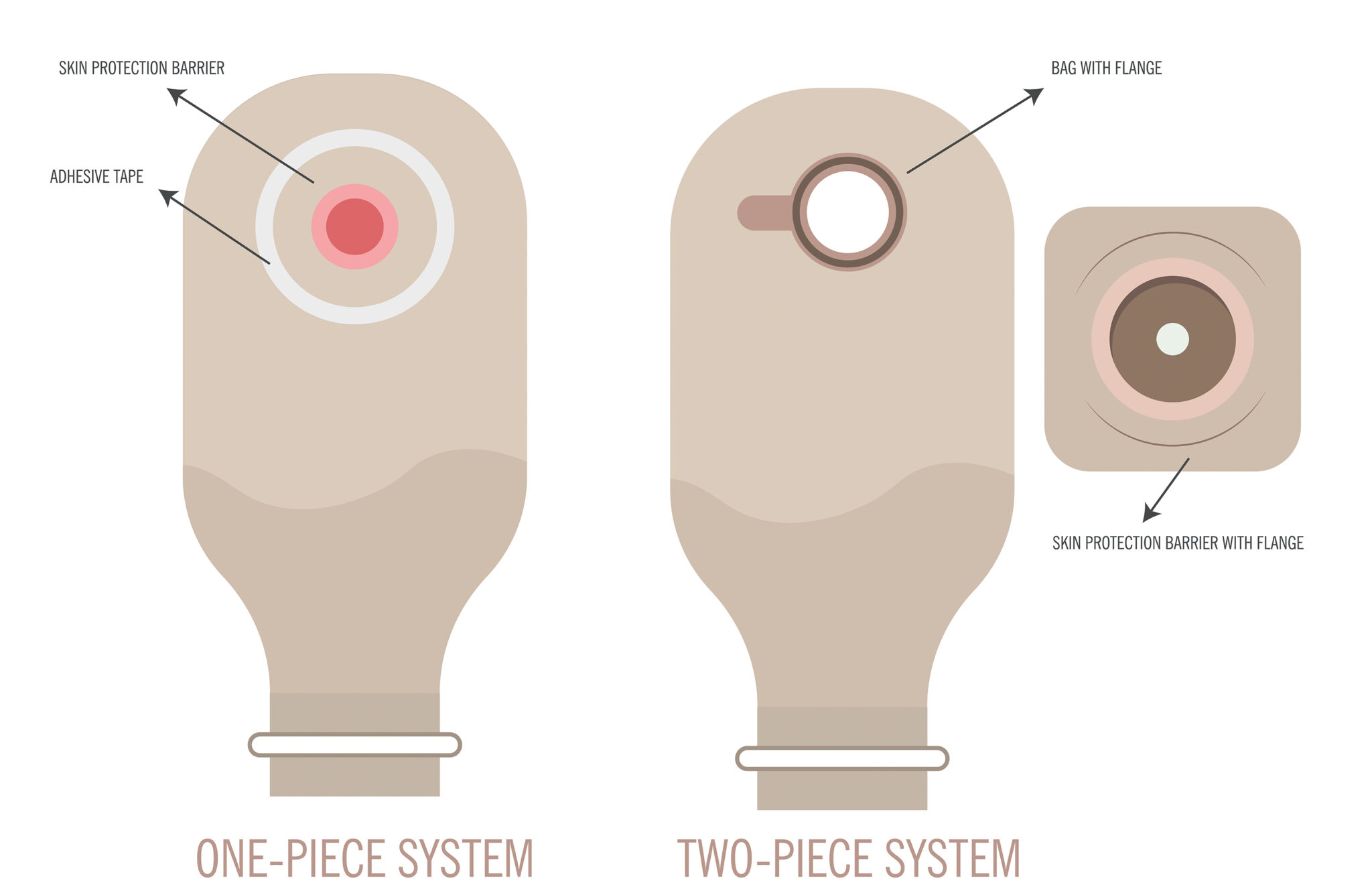 Stoma Device Stoma Pouches and Accessories: A Comprehensive Overview | Stoma Hub